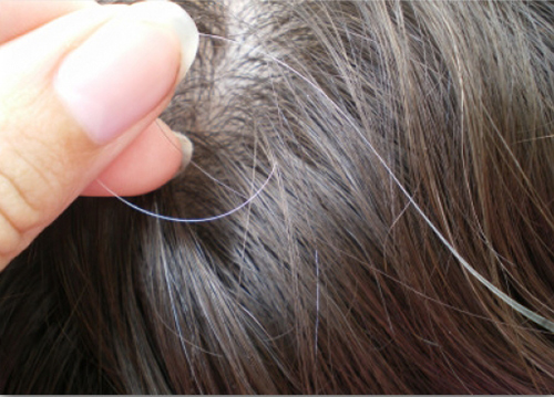 4 giải pháp đẩy lùi hiện tượng tóc bạc sớm - 1
