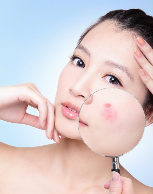 Thói quen xấu khiến làn da bị tàn phá nặng nề - 3