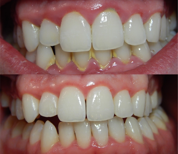 Tổng hợp 10 mẹo làm đẹp tại nhà hiệu quả đến bất ngờ