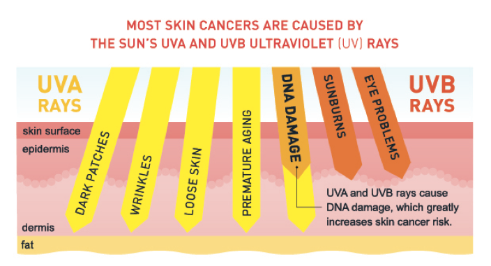 Ánh nắng mặt trời là 1 trong những nguyên nhân gây ra nám da