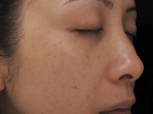 Ưu điểm của dược mỹ phẩm