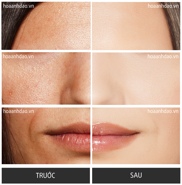 Serum CQ10