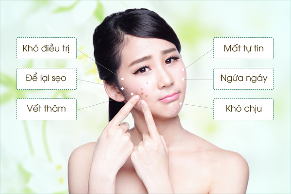 Rau má có tính mát giúp thanh lọc da, ngăn ngừa mụn hiệu quả