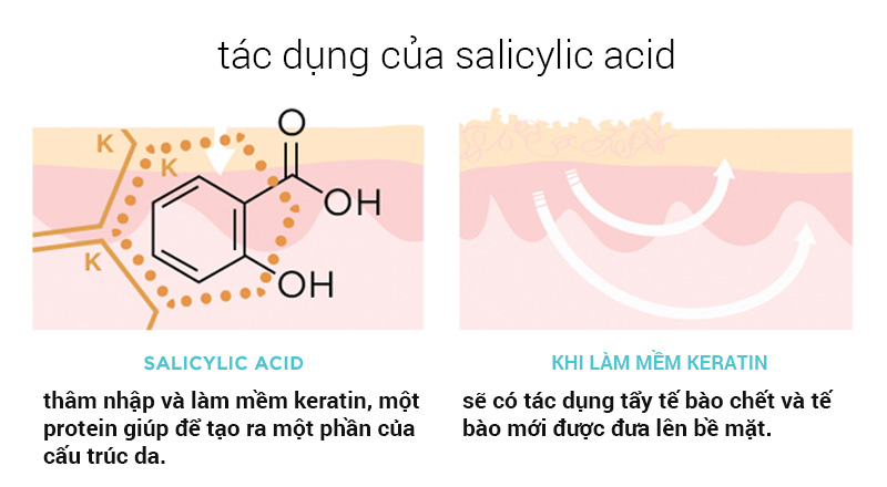 tri-mun-voi-salicylic-acid-va-benzoyl-peroxide-nen-hay-khong-nen-4