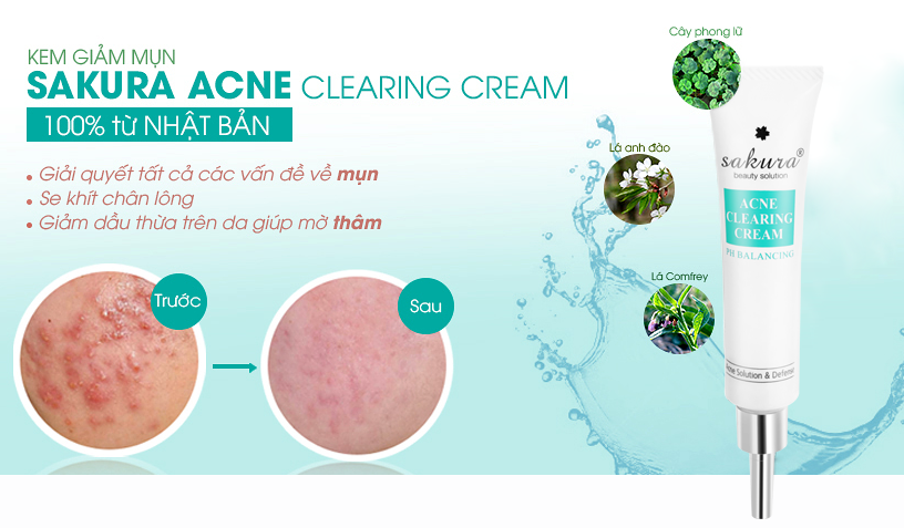 kem giảm mụn Sakura Acne Clearing Cream