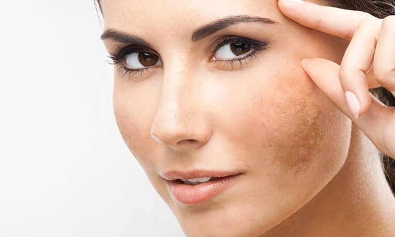 Làn da xuất hiện nhiều dấu hiệu xuống cấp nhanh chóng khi phụ nữ bước sang tuổi 40