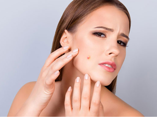 Cách chữa mụn bọc trên da mặt 