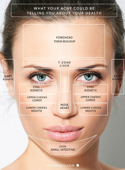 Vị trí nổi mụn cảnh báo về sức khoẻ của bạn