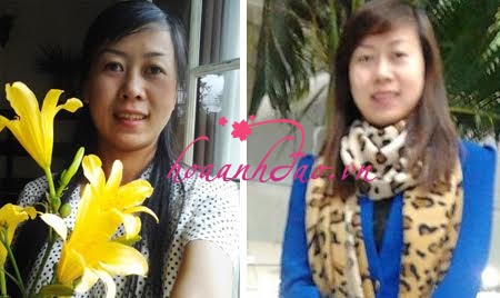 Hình ảnh trước và sau khi giảm nám thành công của chị Trần Như Quỳnh