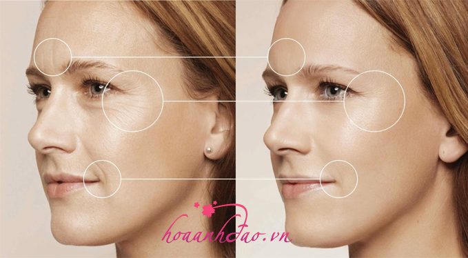 Bí quyết xoá tan nỗi lo lão da chỉ sau 2 tuần cho chị em phụ nữ