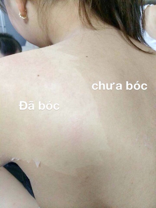Nguy cơ Nguy cơ