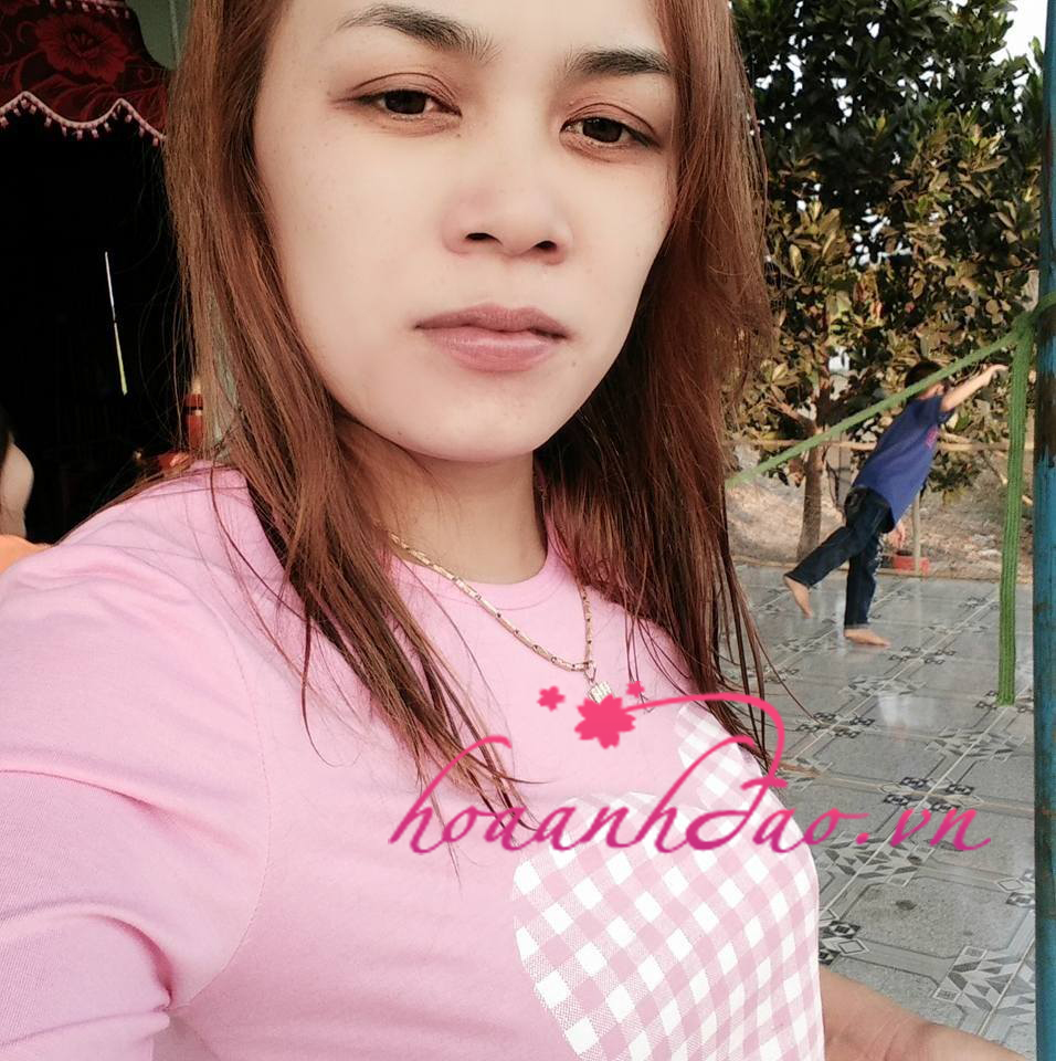 Diễn biến “hành trình” giảm nám da đầy lo lắng hồi hộp của tôi