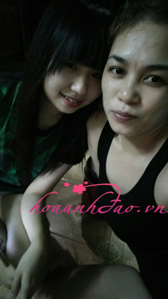 Tìm đủ mọi cách, bỏ ra nhiều tiền để mua mỹ phẩm giảm nám nhưng tốn kém thời gian, tiền bạc chứ chẳng thấy hết nám gì cả