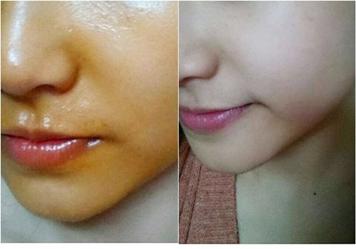 Mặt nạ tinh dầu gấc se lỗ chân lông, sáng da