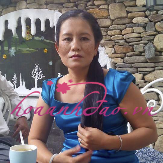 Nếu có kiến thức về làm đẹp, chắc tôi không bị nám nhiều thế này