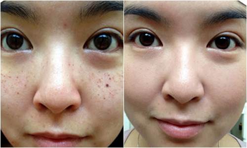 Cách sử dụng cho 3 hỗn hợp trên: