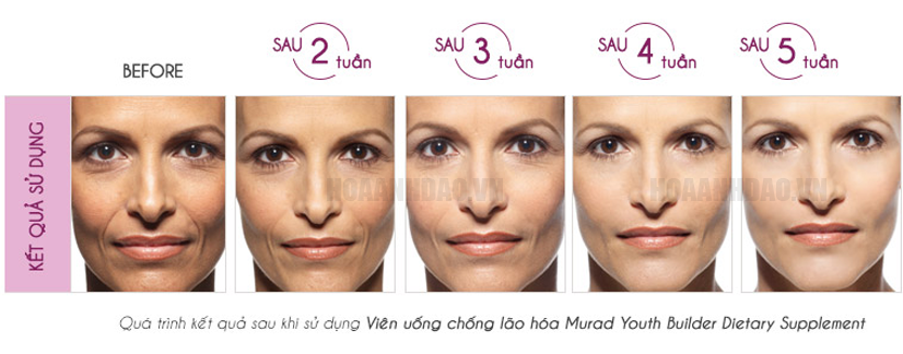 vien-uong-collagen-tre-hoa-da-murad-youth-builder-collagen-supplement
