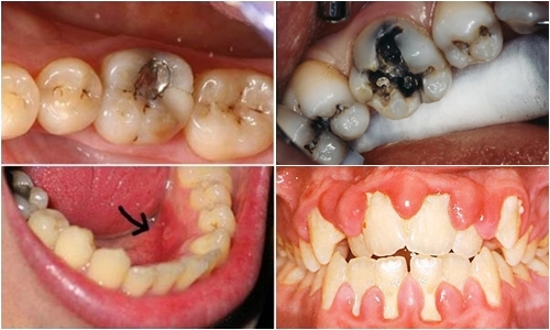 Phá vỡ hệ thống nội tiết