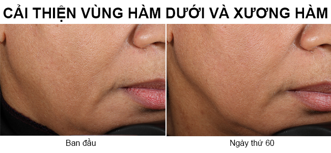 may-massage-nang-co-mat-Nuface-Trinity