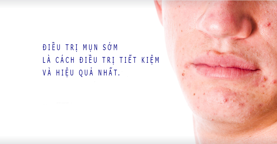 Những thành phần điều trị mụn hiệu quả
