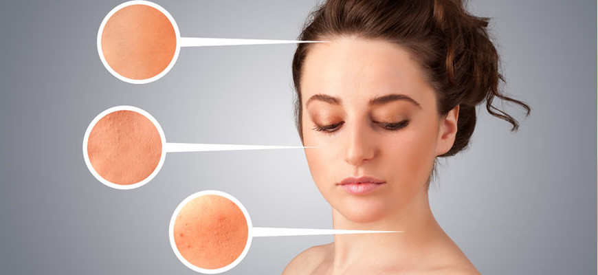 Làm sao để trị hết nám da mặt (phần 1)