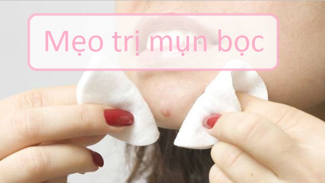 Tuyệt chiêu đánh tan mụn bọc - thanh lọc làn da tại nhà