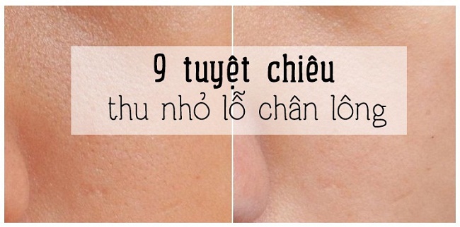 9 cách tự nhiên giúp se khít lỗ chân lông an toàn tại nhà!