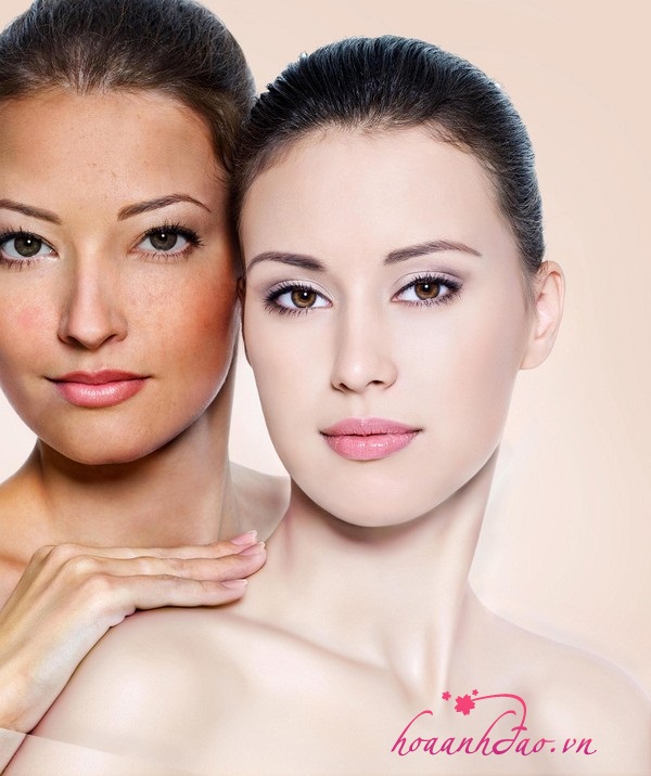 Những thói quen xấu có thể gây nám cho làn da