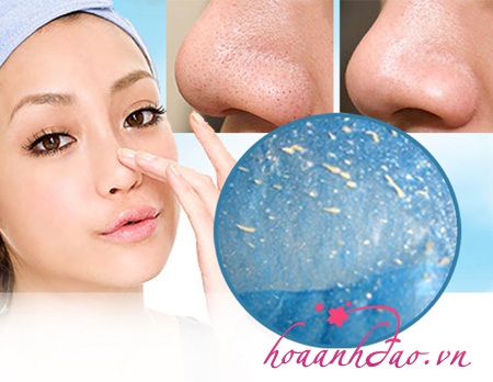 “Tẩy chay” mụn đầu đen hiệu quả tại nhà