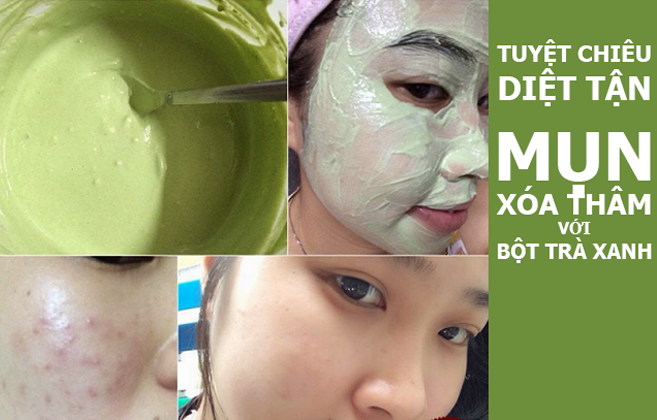 Thử nghiệm sạch boong mụn và thâm chỉ với bột trà xanh