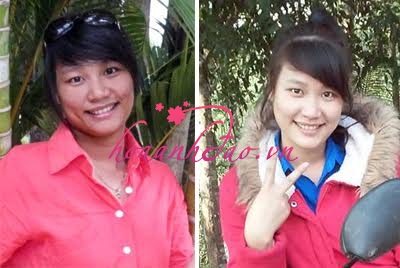 Câu chuyện “tân trang” lại nhan sắc của “bé đen”