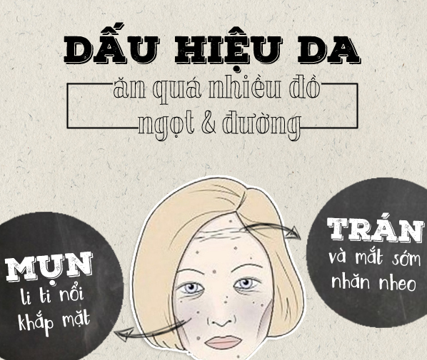 Nhận diện làn da “xấu xí” do ăn quá nhiều béo và đường