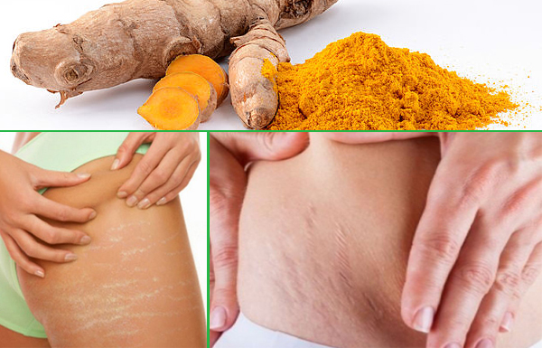 Giải quyết "tất tần tật" các vấn đề về da sau sinh