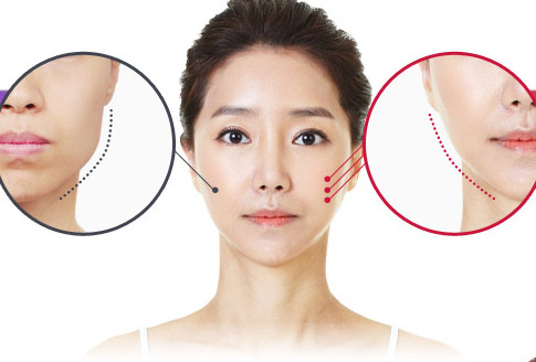 Cách làm nhỏ mặt thon cằm tại nhà không cần phẫu thuật
