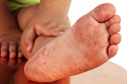 5 loại bệnh chỉ cần dùng nước cơm là khỏi