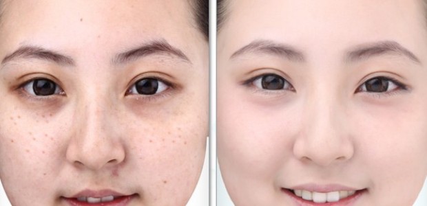 Chỉ cần đắp mặt nạ trà xanh 3 lần/1 tuần vết nám, tàn nhang sẽ tự động biến mất