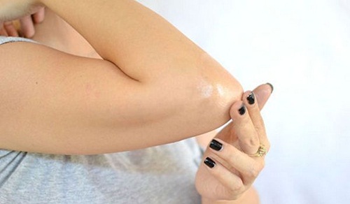 Mẹo nhỏ đánh bay mọi vết thâm sạm khô ráp ở khủy tay đầu gối chỉ trong một nốt nhạc