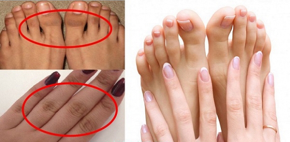 Các vùng khớp tay đen mấy cũng trắng bóc với thành phần tự nhiên
