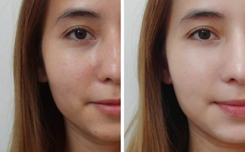 Bận rộn đến mấy cũng nên xông hơi theo cách này ít nhất 2 lần 1 tuần, nếu không bạn sẽ tiếc cả đời