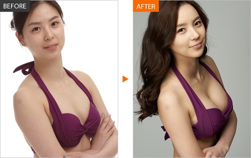 Ngực nở chỉ trong 1 tuần mà chưa đến 10 nghìn đồng