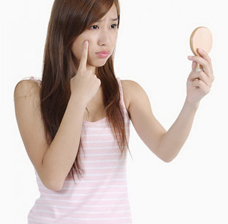 Bí quyết trị tàn nhang hiệu quả cho tuổi dậy thì