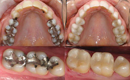 Súc miệng với thứ này 30 giây, sâu răng ê buốt, hôi miệng kinh niên cũng phải chấm dứt