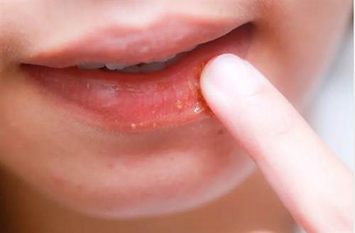 Bỏ ra 5 phút làm hỗn hợp này, môi lúc nào cũng căng mọng, mướt mịn như vừa đánh son