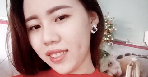 Nếu bạn cho rằng TÀN NHANG HAY NÁM KHÔNG THỂ CHỮA KHỎI thì chị Hạ Vi sẽ nói rằng: Bạn SAI rồi!