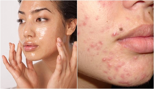 Sai lầm phá hủy làn da vì dùng dầu dừa không đúng cách