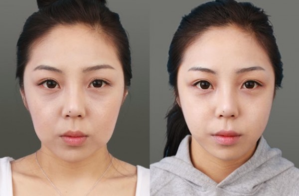 Bỏ thứ này vào nước rồi rửa mặt hàng ngày, da láng mịn, trắng muốt trẻ đẹp hẳn ra