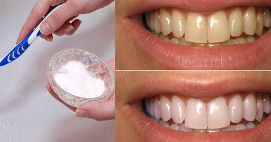 Dùng muối theo cách này, răng ố vàng lâu năm, mùi hôi miệng khó chịu sẽ biến mất