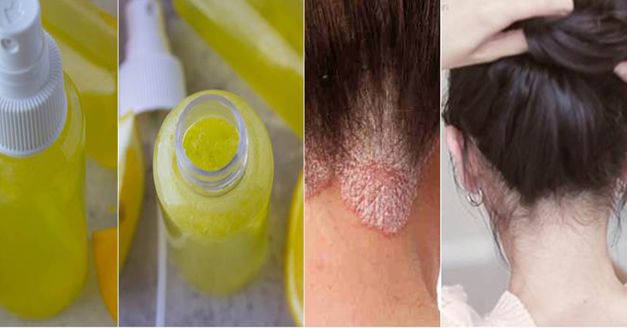 Mua ngay 5 quả chanh để sẵn trong tủ lạnh để làm đẹp theo cách này