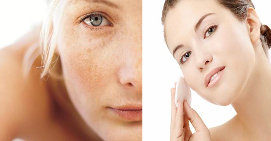 Thoa một giọt giấm táo lên mặt, bạn sẽ thấy lợi ích làm đẹp từ "thần dược" này