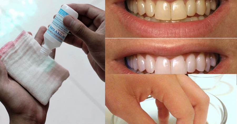 7 lý do chứng minh oxy già là mỹ phẩm tuyệt vời nhất, là con gái nhất định phải mua 1 lọ về làm đẹp